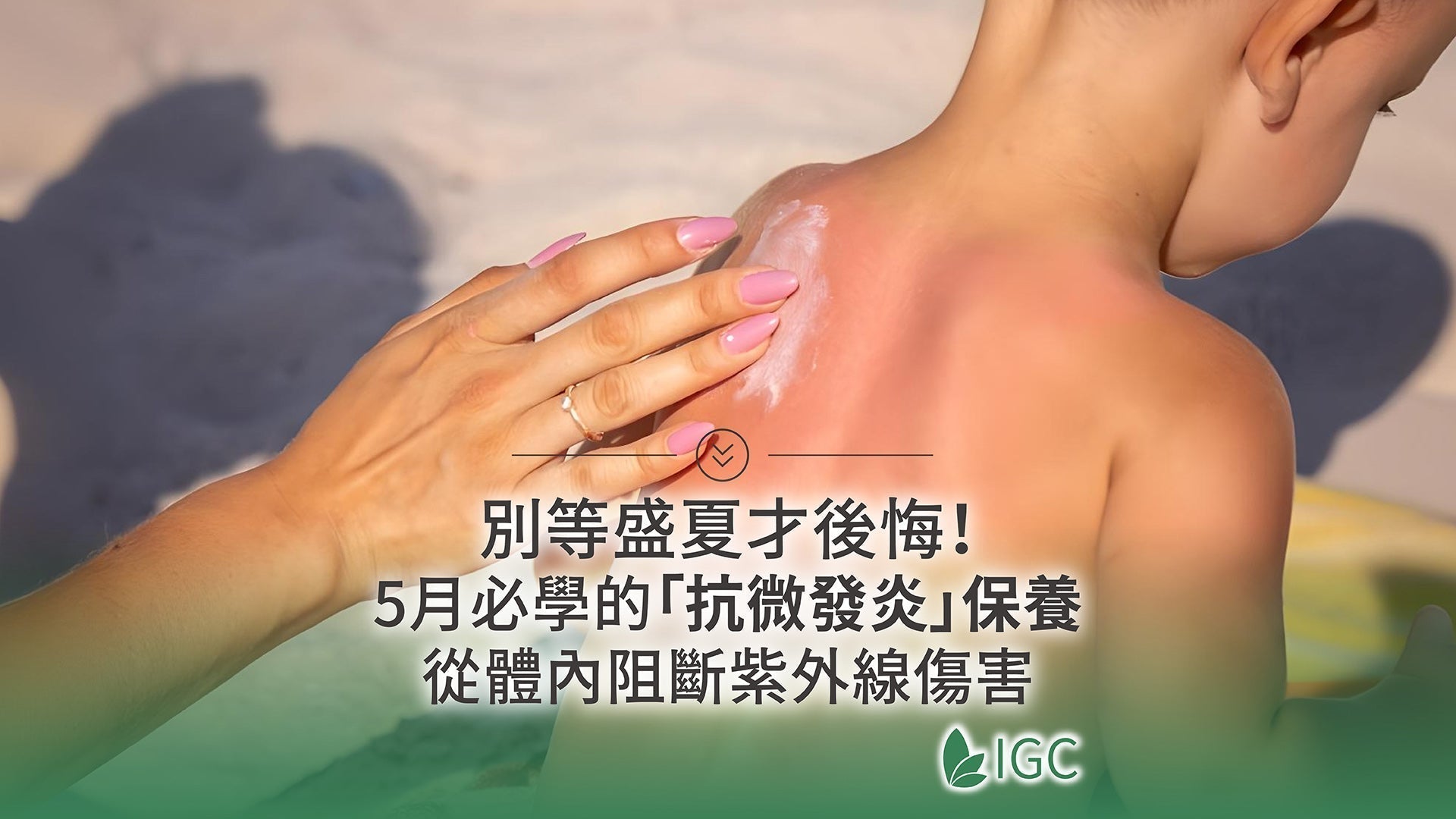 別等盛夏才後悔！5月必學的「抗微發炎」保養，從體內阻斷紫外線傷害 - Imagine Global Care